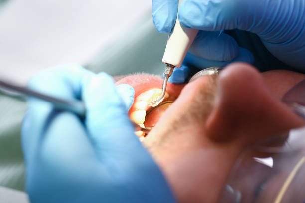 Best Emergency Dental Care for Sports Injuries in Calverton, MD